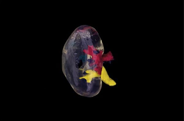 1516775948146854.png 0.png